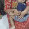 Balita 3 Tahun di Kota Jambi Dievakuasi Usai Jari Terjepit Seng